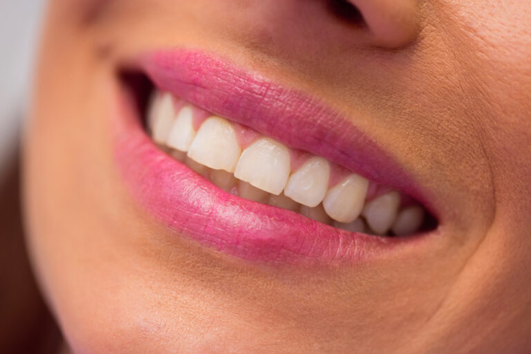 Comment-blanchir-les-dents-Nos-solutions-efficaces