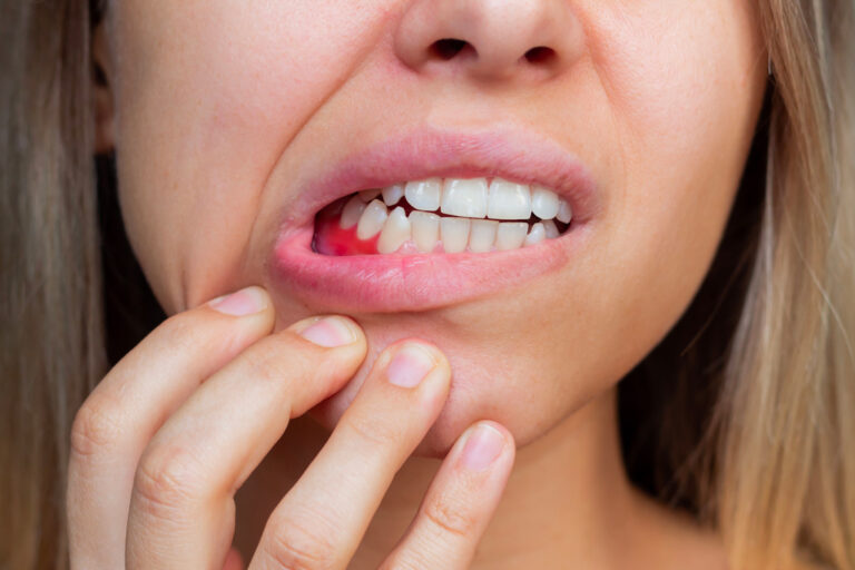 Parodontite-avis-de-dentiste-causes-et-traitements